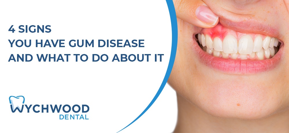 4 Signs You Have Gum Disease and What to Do About It