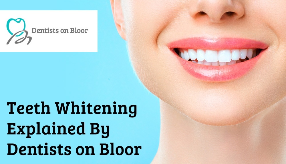 Blog by Dentists on Bloor