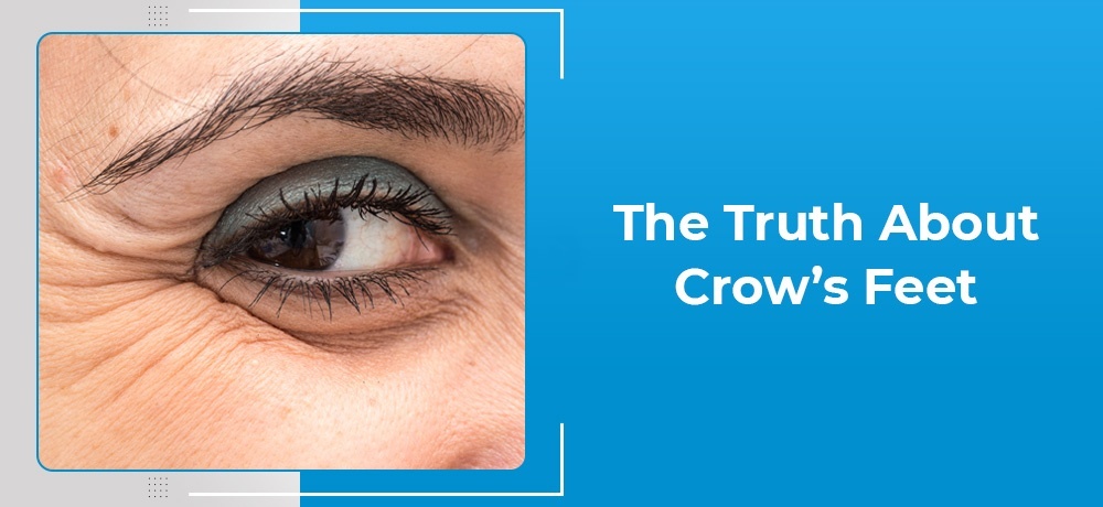 The Truth About Crow’s Feet - Blog Post By Doctors Eyecare Wetaskiwin.jpg
