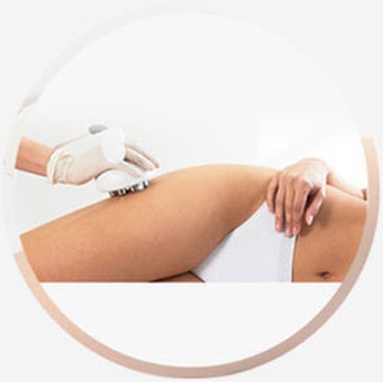 Calgary Skin Tightening, Body Contouring Services - Advance Laser Clinic