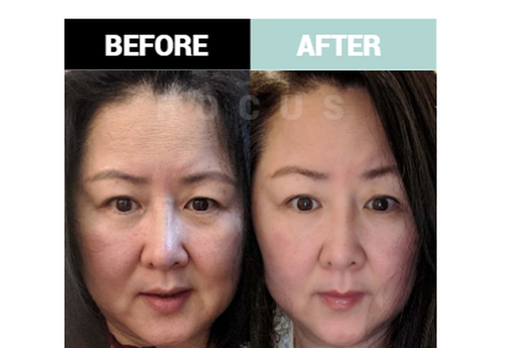 Before and After a Massage Therapy by Focus Body Care
