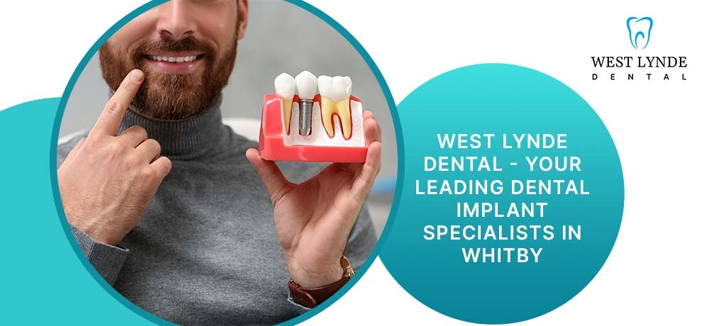 West Lynde Dental - Your Leading Dental Implant Specialists in Whitby.jpg