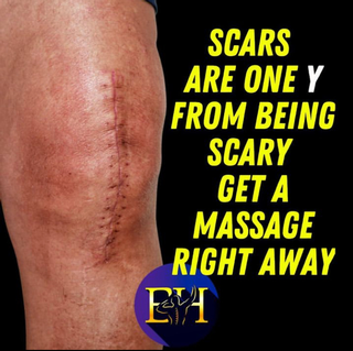 Gallery-Scars-And-Massage.png