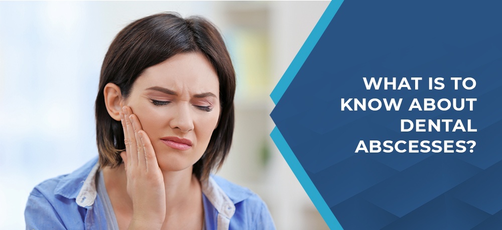 WHAT IS TO KNOW ABOUT DENTAL ABSCESSES