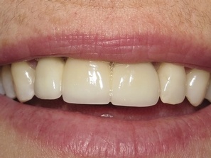 Wychwood Dental - Smile Gallery