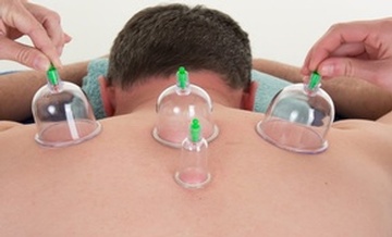 Cupping Therapy at Cuba Goa