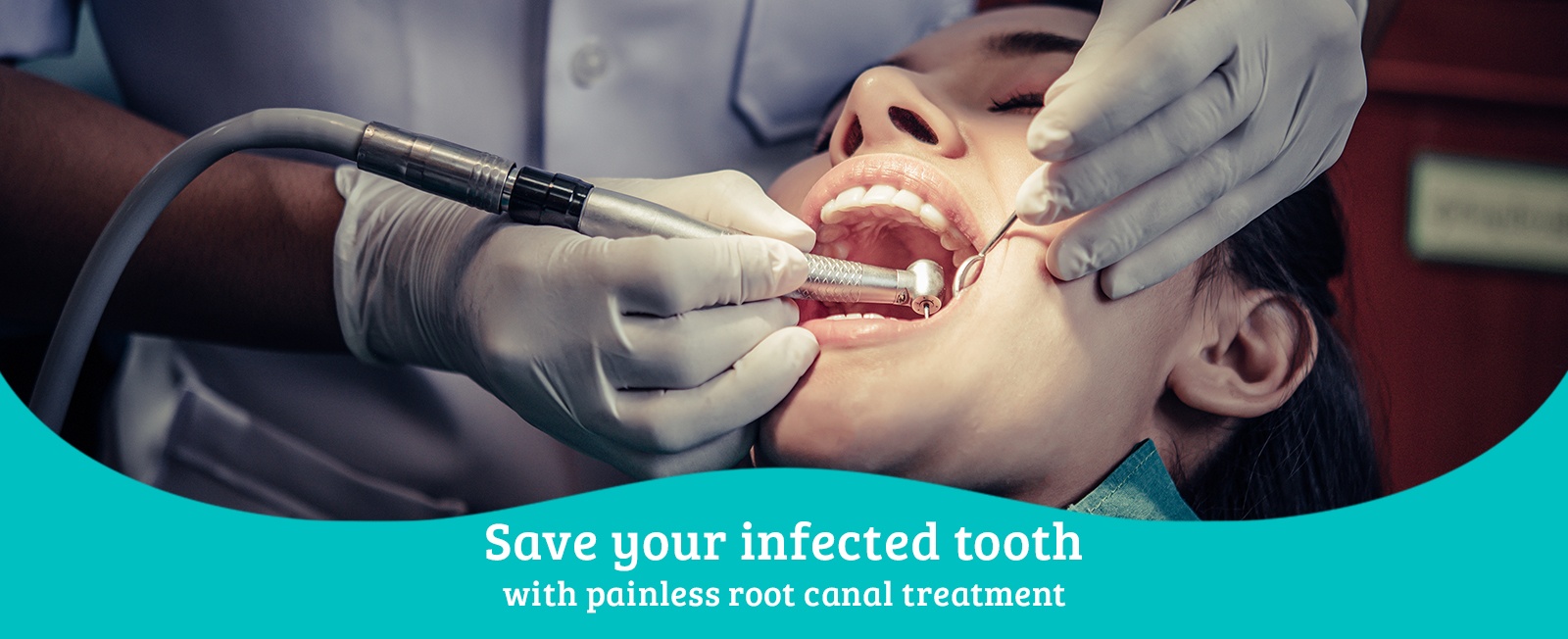 Root Canal Treatment Toronto by Dentists on Bloor