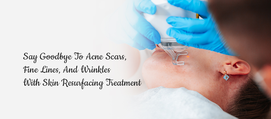 Say Goodbye To Acne Scars, Fine Lines, And Wrinkles With Skin Resurfacing Treatment