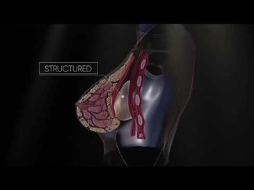 Structured IMPLANT Breast Animation