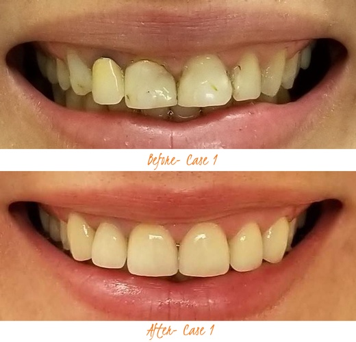 Dental Treatment Vaughan by Dentistry on Jane - Dentist