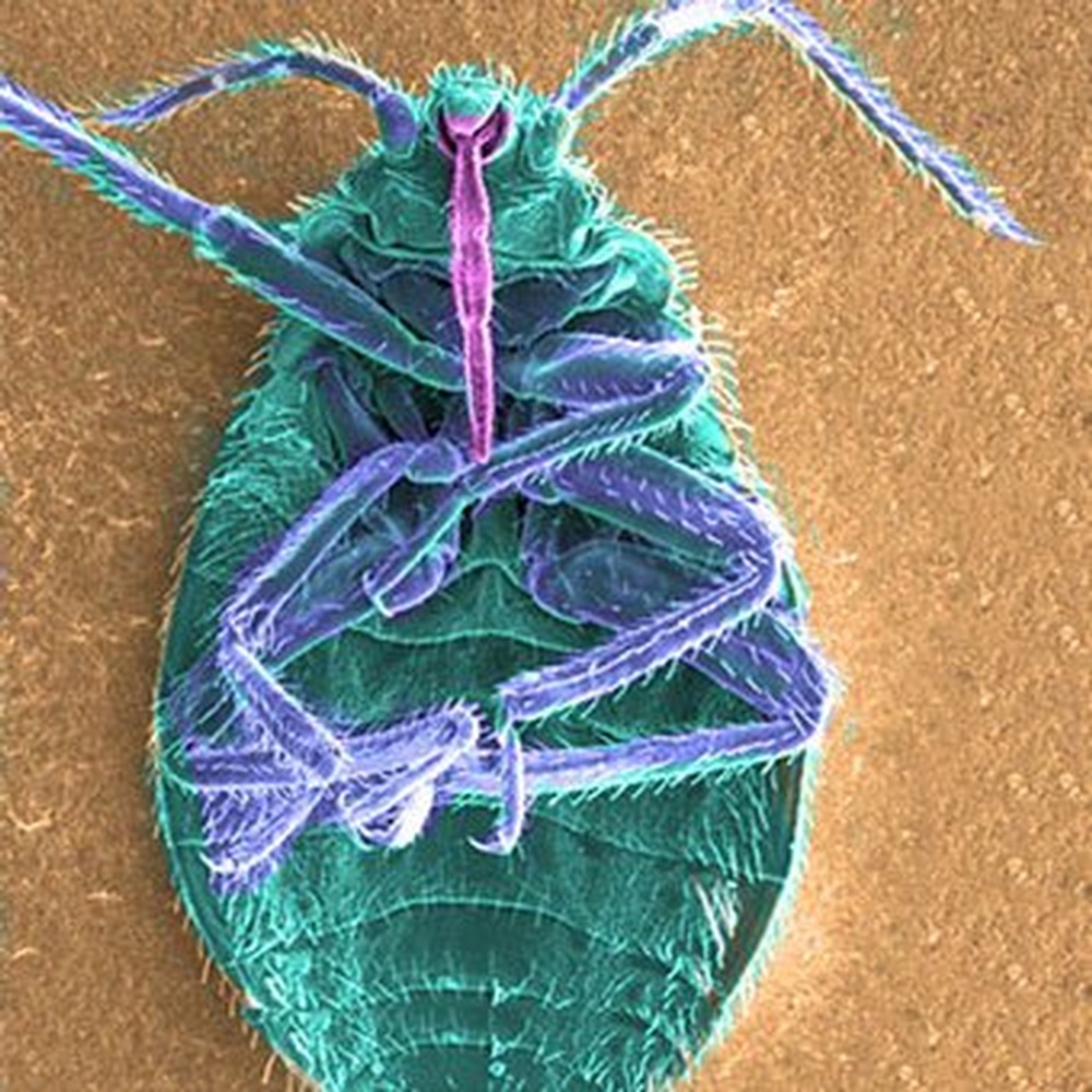 bedbugs-s1-magnified-facts.jpg