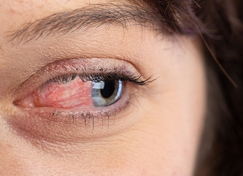 Ocular disease diagnosis and management (AMD,glaucoma)