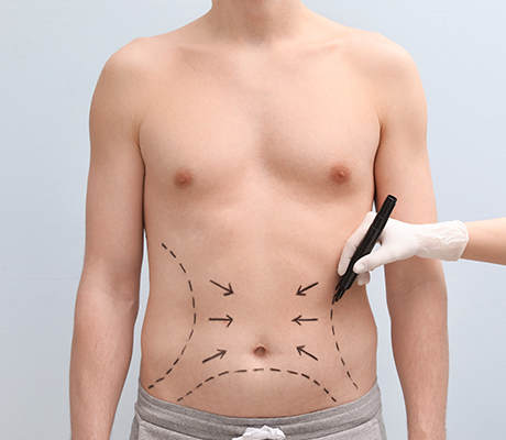 Confidence Boost: How Liposuction For Men Can Increase Confidence