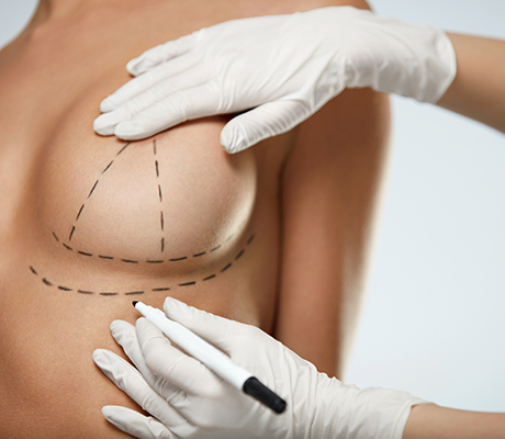 Breast Lift and Reduction in Toronto: Elevate Your Confidence and Comfort