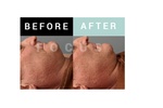 Check out what happens after a Massage Therapy by Focus Body Care