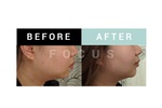 Before and After a Massage Therapy by Focus Body Care in Edmonton, Leduc 