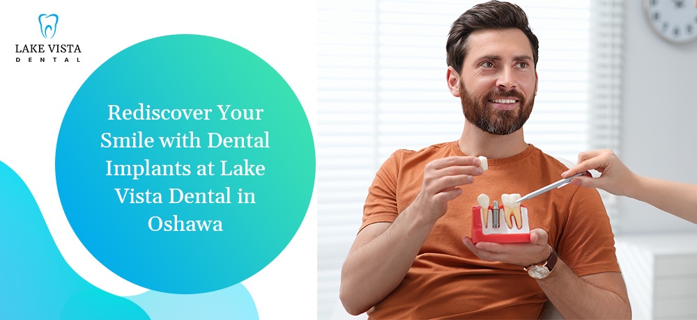  Blog by Lake Vista Dental