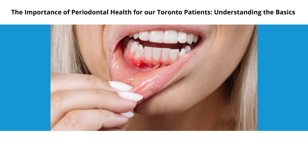 Blog by Yonge Eglinton Periodontics