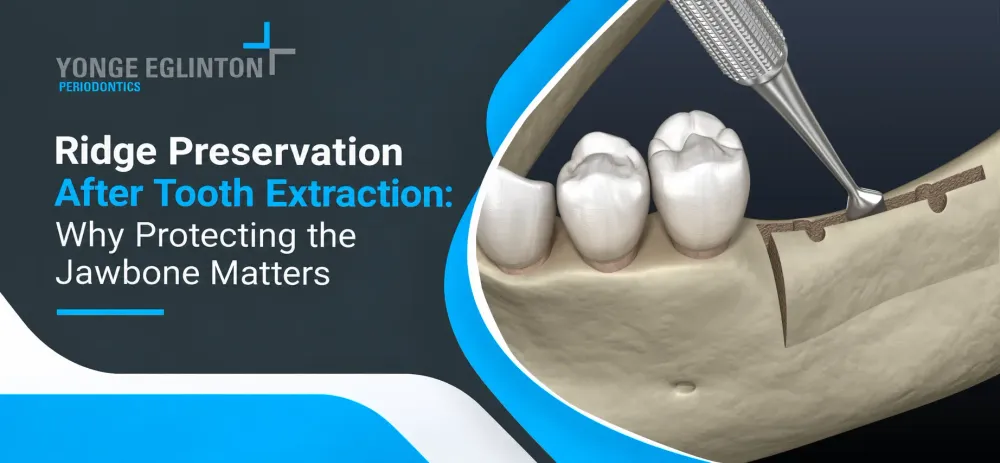 Blog by Yonge Eglinton Periodontics