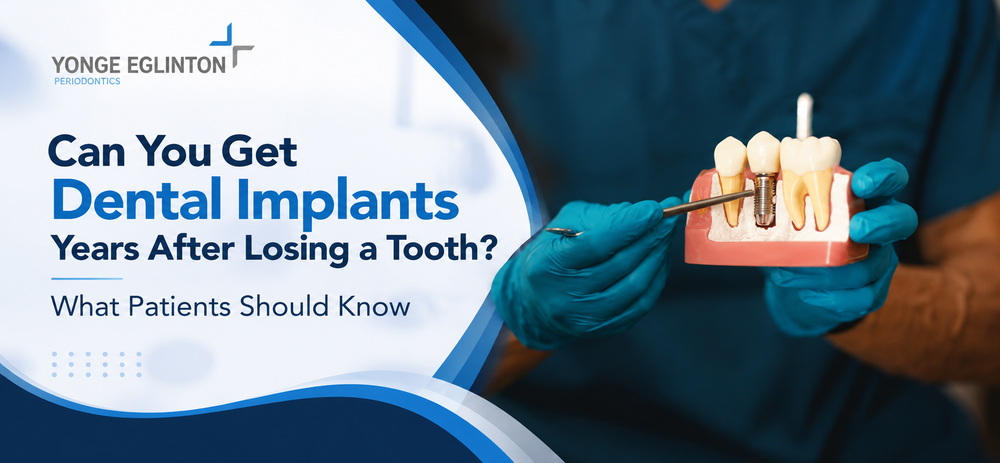 Blog by Yonge Eglinton Periodontics