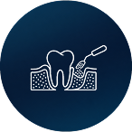 Bone Grafting and Tissue Regeneration