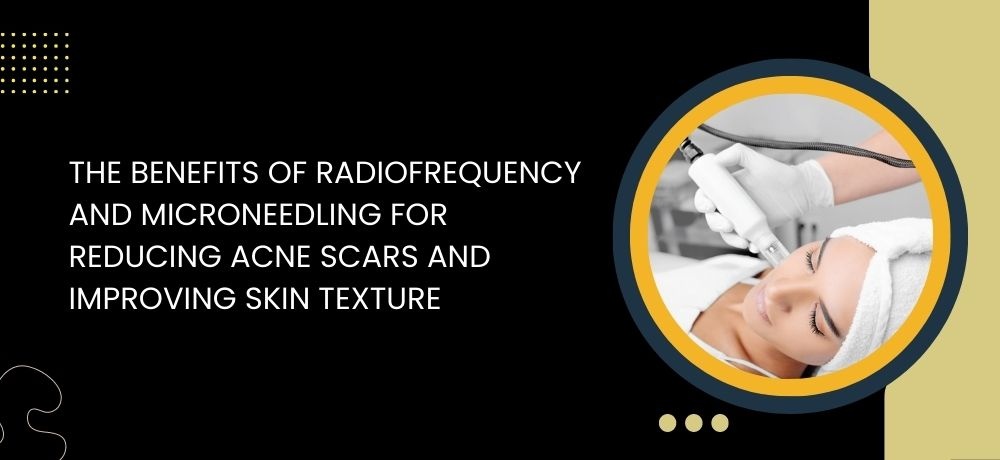 The Benefits Of Radiofrequency and Microneedling For Reducing Acne Scars And Improving Skin Texture 