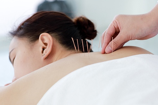 Medical Acupuncture: An Effective Treatment for Various Health Conditions in Scarborough, Toronto
