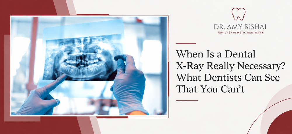 When Is a Dental X-Ray Really Necessary? What Dentists Can See That You Can’t