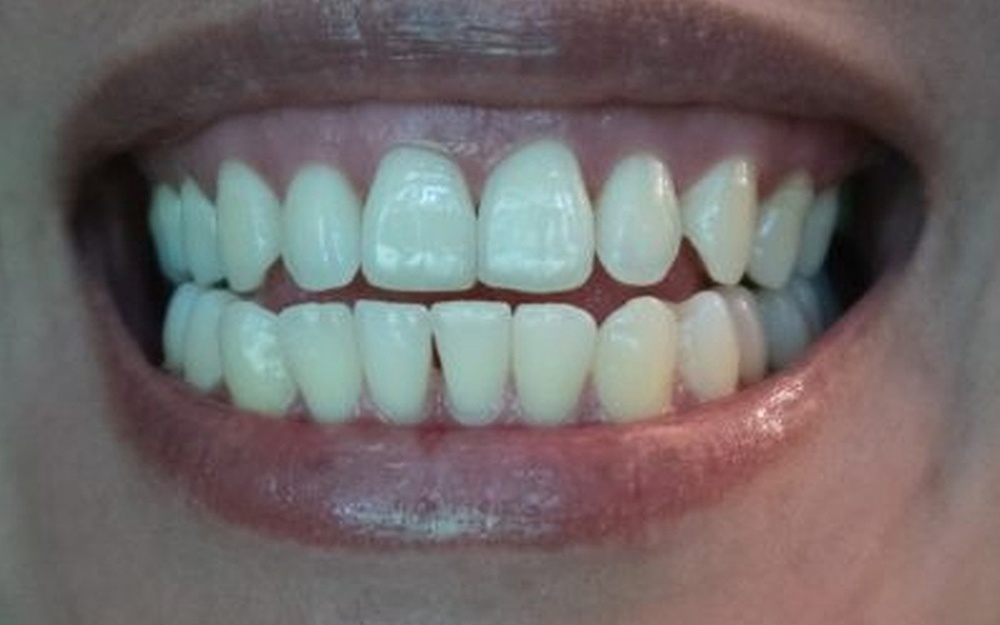 Blog by Stroud Dental