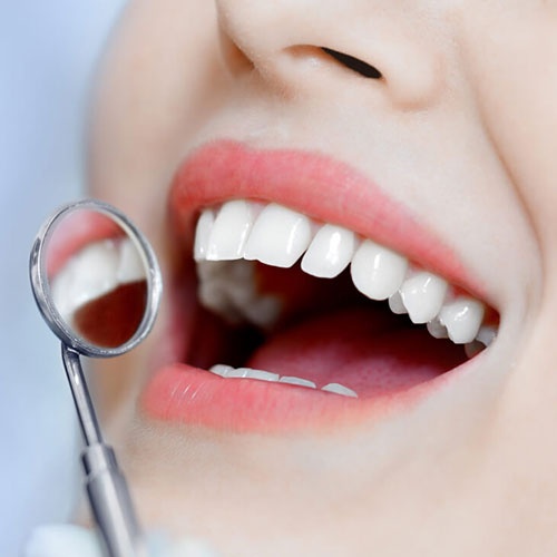 Dental Hygienist Burlington