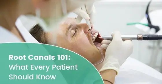 Root Canals 101: What Every Patient Should Know