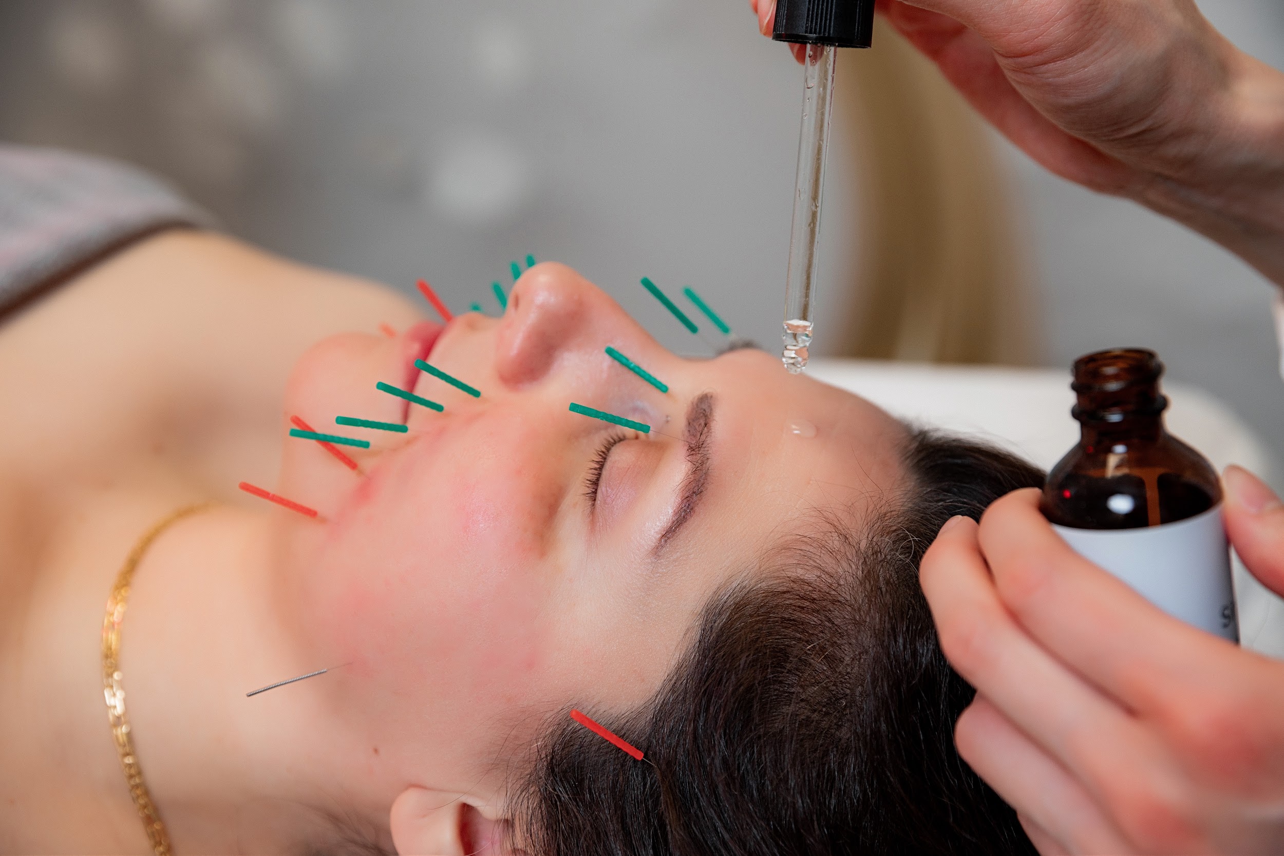 Revitalize Your Skin Naturally with Acufacial Therapy in North York