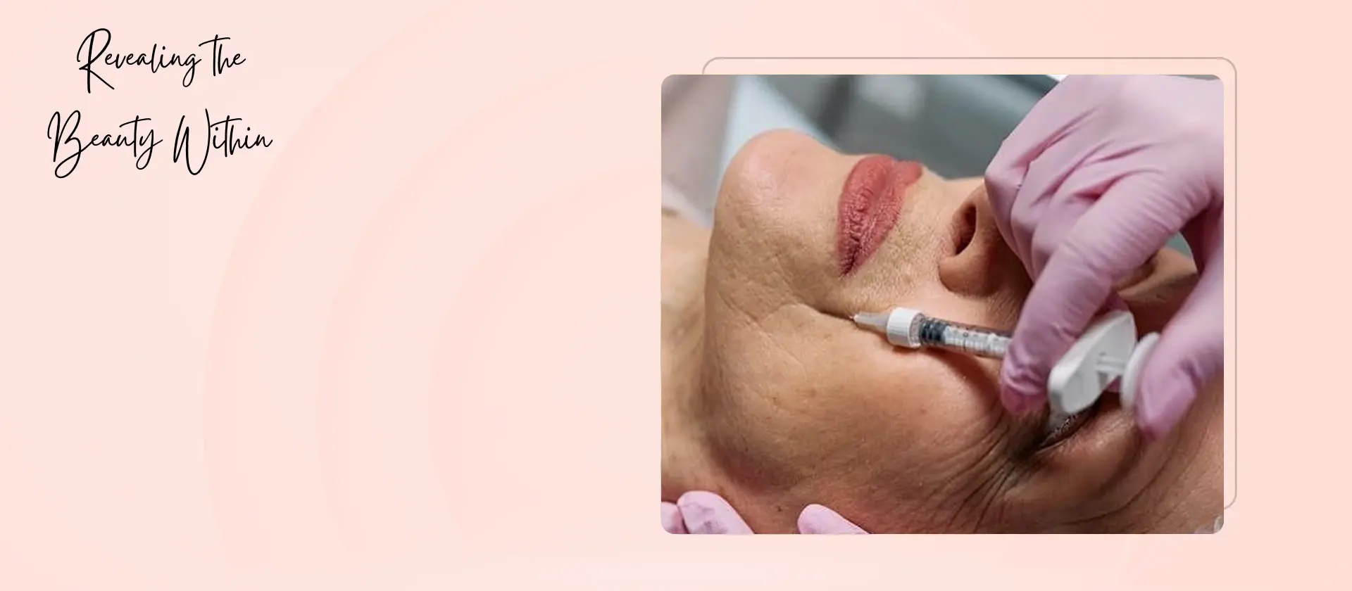 Revitalize your look with our expert Facial Fillers in Staten Island, blending artistry and precision