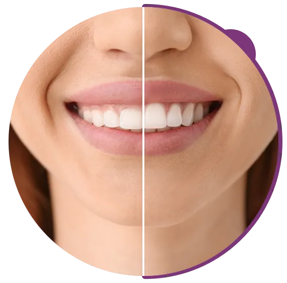 Reshape Your Gums for a More Confident Smile