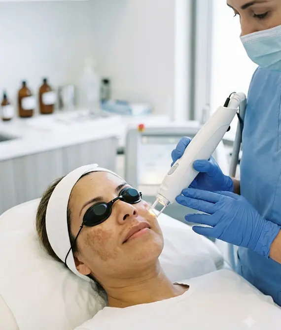 Professional melasma treatment at Peak Performance Health Clinic