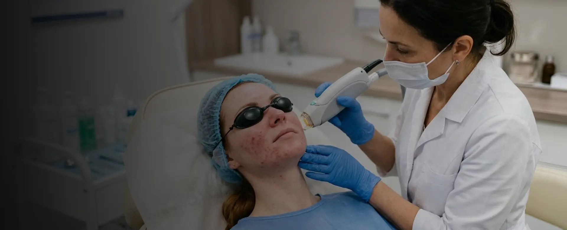 Rosacea Treatment in Clarksville TN
