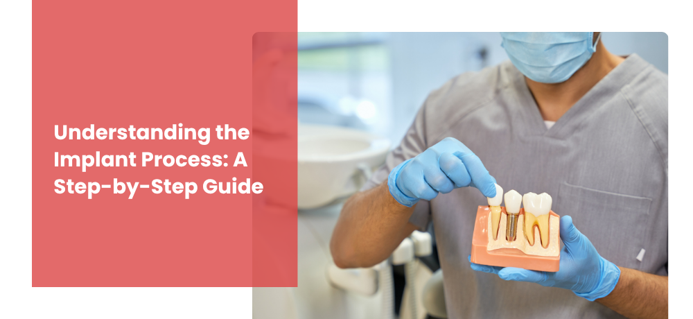 Blog by ELEMENTS DENTAL OF NY