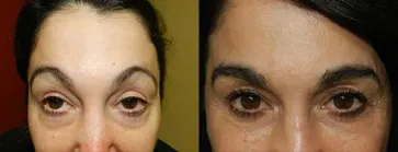 San Francisco Hair Transplant Clinic
