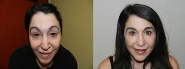 San Francisco Hair Transplant Clinic