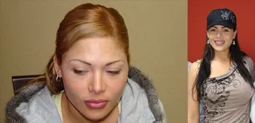 San Francisco Hair Transplant Clinic