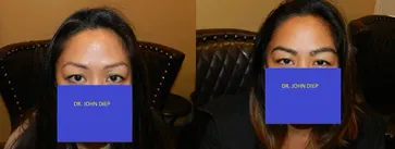 San Francisco Hair Transplant Clinic