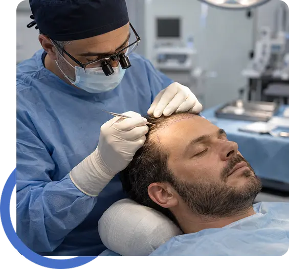 Hair Restoration for Fremont Residents