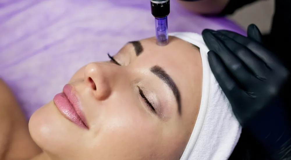 Exploring the Science Behind Microneedling for Skin Rejuvenation.webp