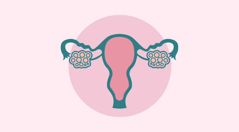 Gynecology, OB/GYN Education Let’s Talk About PCOS